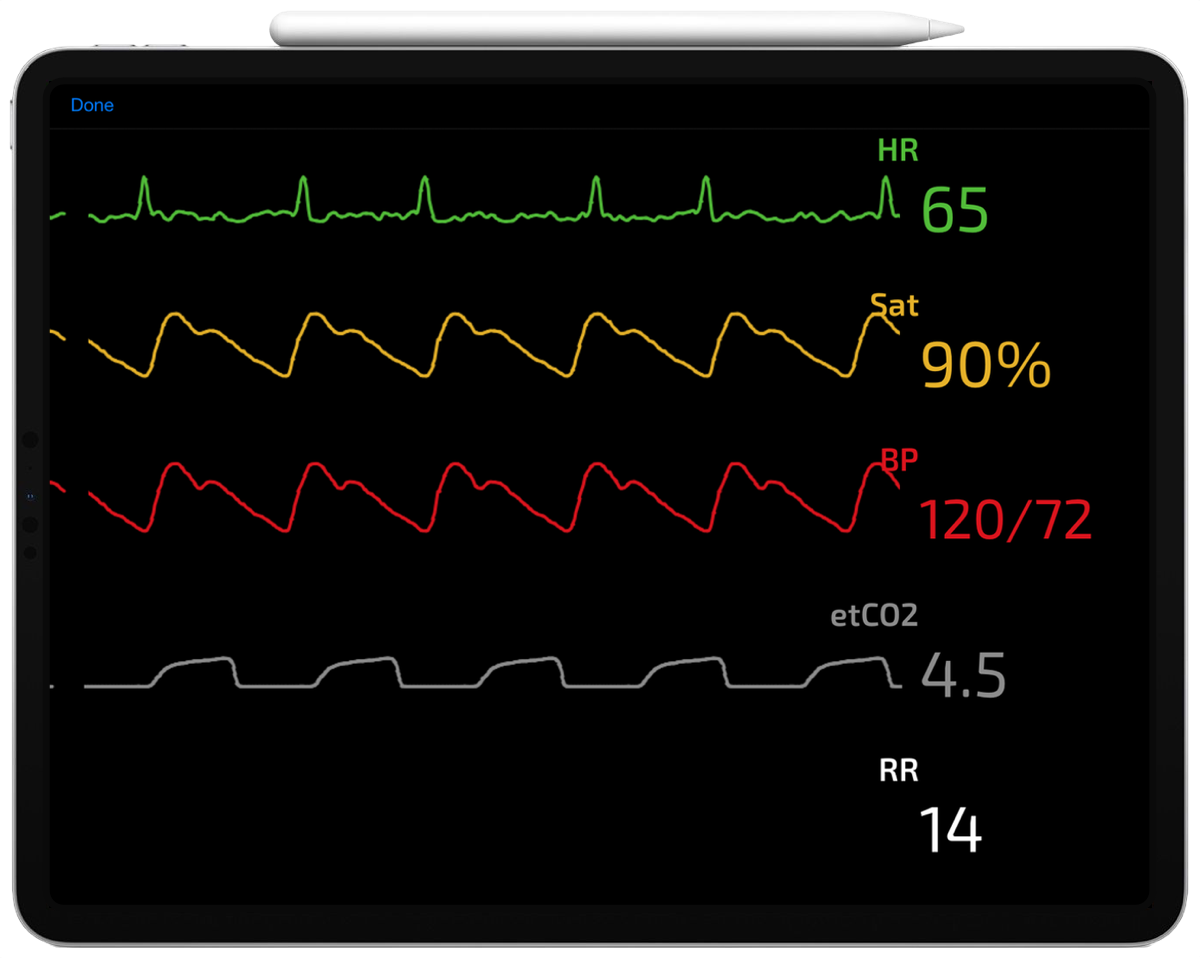 SimMon running on iPad — showing ECG, SpO₂, BP, etCO₂ and RR waveforms